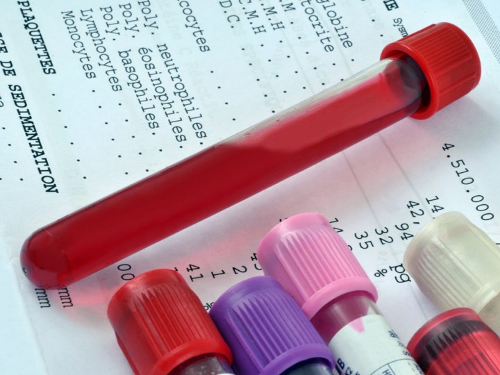 Blood test results
