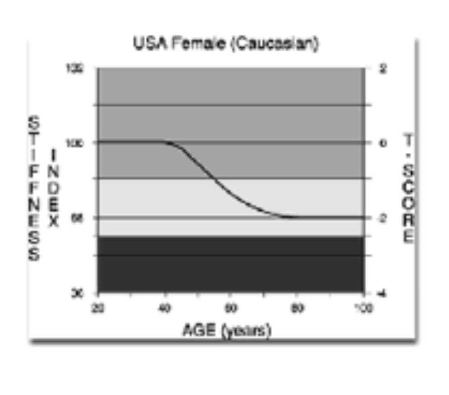 Example T-score